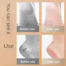 Premium Silicone Heel Protectors